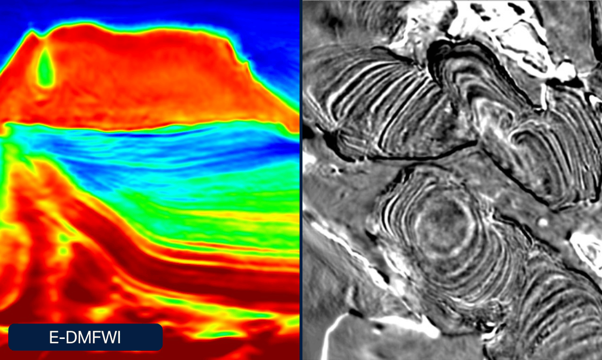 Dynamic Matching FWI (DM FWI) | TGS Imaging & Processing